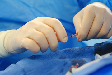 Operations to remove blood clots. Endovascular surgery. Surgical interventions on blood vessels. The surgeon's hands.