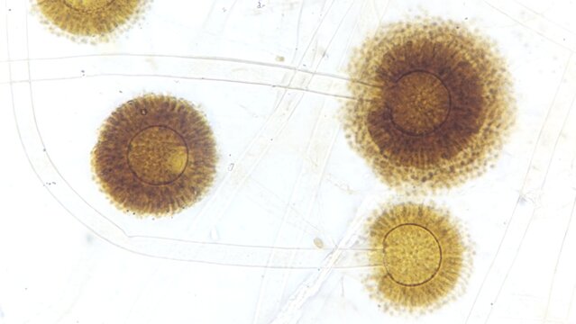 Aspergillus conidiophore under the light microscope