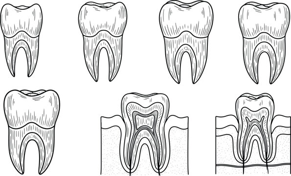 Tooth anatomy diagram set showing enamel, dentin, pulp, and root structure