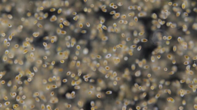 Trochophore larvae under a microscope, possibly at stage of parenchymella from phylum Porifera. Sample was in White Sea.