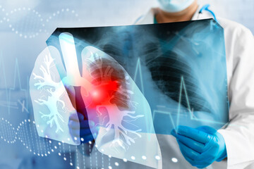 Doctor examines lung x-ray with highlighted area and heart monitor in healthcare setting