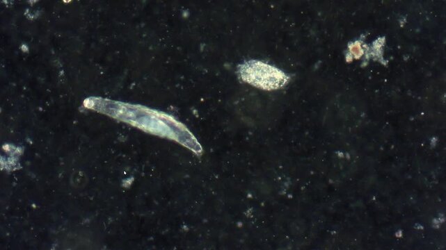 Microscopic view of the rotifer Adineta vaga, moving rapidly under a microscope in water among the simplest.