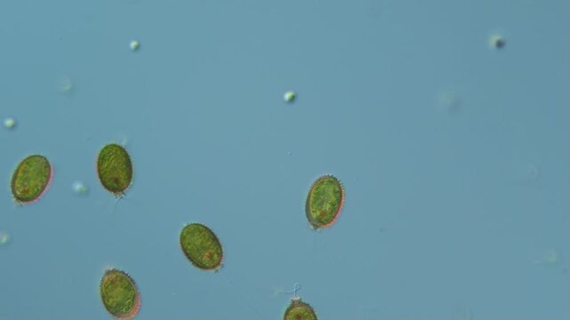 Algenbl&uuml;te: die Gr&uuml;nalge Trachelomonas in einem Wassertropfen aus S&uuml;&szlig;wasser