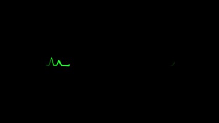 Green line graph pulse heartbeat monitor ecg medical rhythm wave signal technology abstract dark background data visualization - Powered by Adobe
