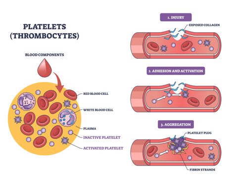 Platelets thrombocytes visual shows vessel injury, adhesion and aggregation forming a platelet plug, key objects, platelets, red blood cells, fibrin strands, transparent background.