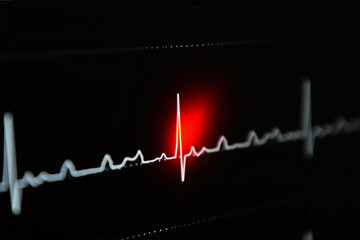 Glowing red heart beat line on black background medical monitor electrocardiogram pulse