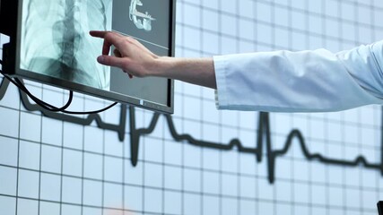Doctor discussing heart X-ray with EKG wave, analyzing medical data and diagnosis