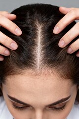 Naklejka premium Hand touching oily scalp and thin hair roots texture