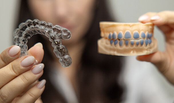 Woman holds whitening trays and hydrogen peroxide syringes, smiling while showing a dental model. White backdrop, close frames with trays, gel and tooth care tools for a bright healthy smile.