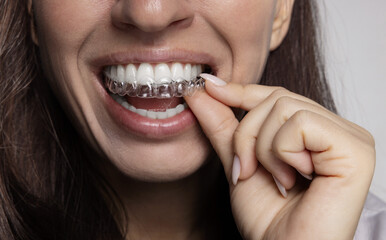 Woman holds whitening trays and hydrogen peroxide syringes, smiling while showing a dental model. White backdrop, close frames with trays, gel and tooth care tools for a bright healthy smile.