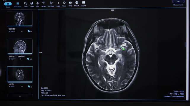 Examining MRI scans using digital gadget in office of the modern clinic. Diagnostic technology for accurate and efficient medical care.