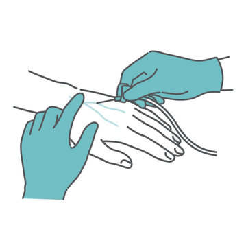 点滴のルート確保（静脈穿刺）のイラスト