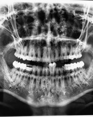Dental X-ray. Dental examination, health