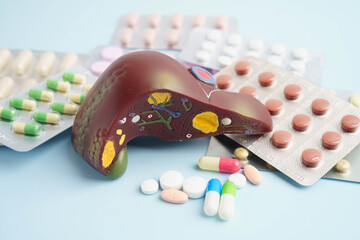Liver model with pill drug treatment, Cirrhosis, Liver cancer, fatty liver.