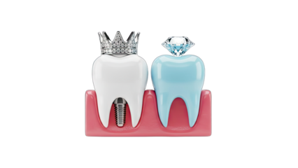 Dental implant crown with diamond and king crown on blue tooth in healthy pink gums against black background isolated close up