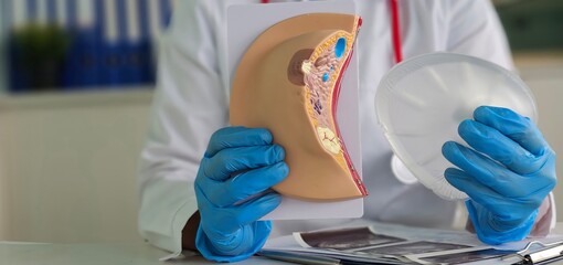 Doctor holds breast implant and explains benefits to patient
