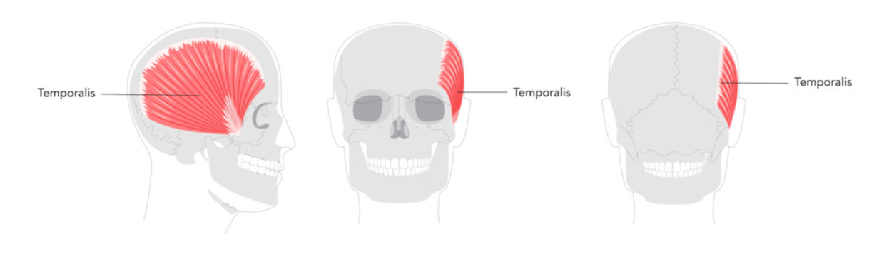 Temporalis - Human jaw muscle displayed in detailed anatomy chart, controls elevation and retraction of the mandible, important for masticatory function and clinical reference