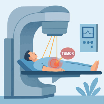 Radiotherapy Cancer Treatment Flat Illustration