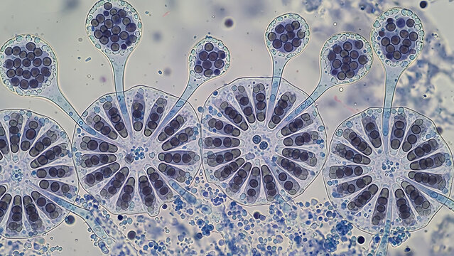 Detailed microscopic view of fungal structures with radiating spore-producing heads and mycelial growth