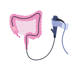 Colonoscopy procedure. Examination and treatment of the large intestine. Flat vector illustration of an invasive medical procedure
