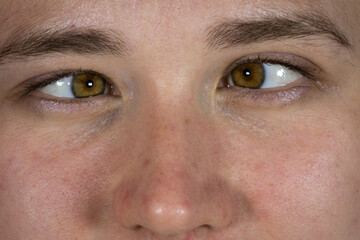Close view of a person's eyes with a neutral expression in a well-lit setting during daytime