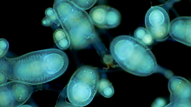 Microscopic Vorticella protozoa filter feeding on black background, science use