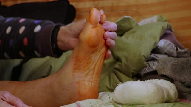 Home rehabilitation of an elderly woman after a tibia fracture with plates installed, leg exercise with an elastic band on a bed