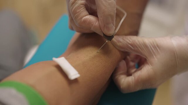 Close-up of healthcare professional wearing sterile gloves performing blood draw on patient arm at clinic, inserting needle to collect sample for medical testing and diagnosis. Shooting in slow motion