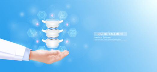 Disc replacement model in doctor hand. Bone spinal joint surrounded by medical icons. Technologies in science health care. Realistic 3D Vector.