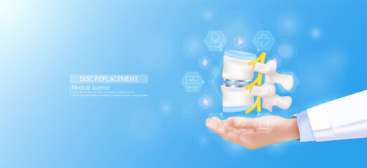 Disc replacement model in doctor hand. Vertebra bone joint surrounded by medical icons. Technologies in science health care. Realistic 3D Vector.