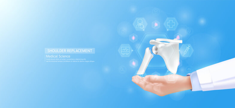 Shoulder replacement model in doctor hand. Joint bone surrounded by medical icons. Technologies in science health care. Realistic 3D Vector.