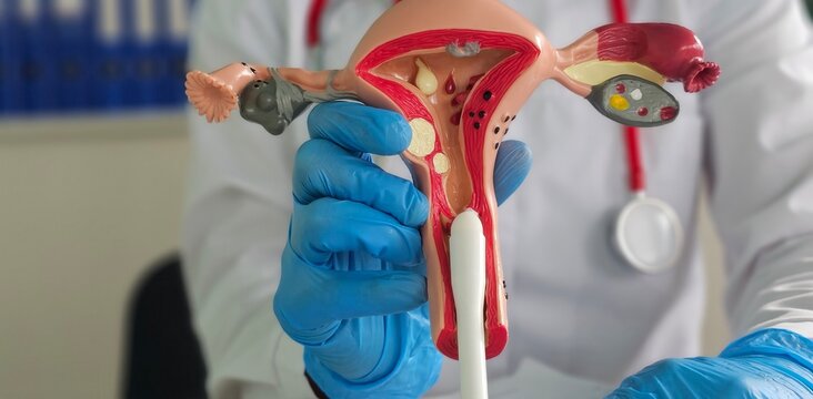 Model of female reproductive system and medical suppository tablet