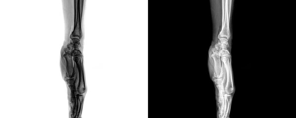 Wrist Lateral View X-Ray Radiograph Showing Clear Visualization of Carpal Bones and Joint Alignment for Assessment of Fractures, Dislocations, Isolated on Transparent