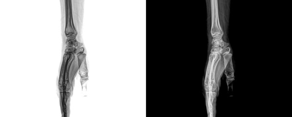 Wrist Lateral Projection X-Ray Image Demonstrating Detailed Bone and Joint Structure for Diagnosis Isolated on Transparent Background