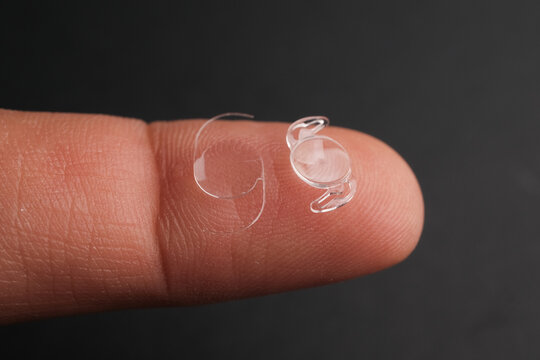 Microscopic View of a Clear, Biocompatible Acrylic Phaco-Foldable Intraocular Lens (IOL) Ready for Implantation in the Human Eye to Restore Vis