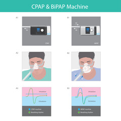 Comparison of CPAP and BiPAP Machine Function