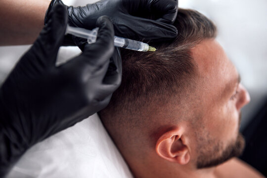 Male undergoing hair restoration treatment with a syringe in a modern salon, showcasing the process of scalp micropigmentation and hair rejuvenation techniques