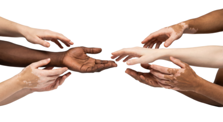 interconnected hands representing diverse skin tones and textures extending towards each other