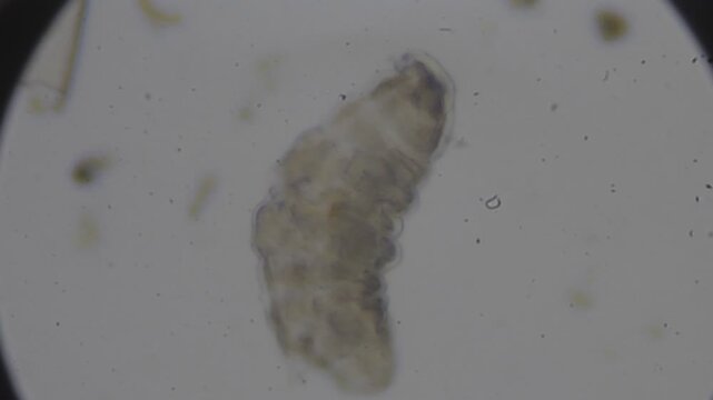 Highly magnified view of a tardigrade (water bear) under a microscope.