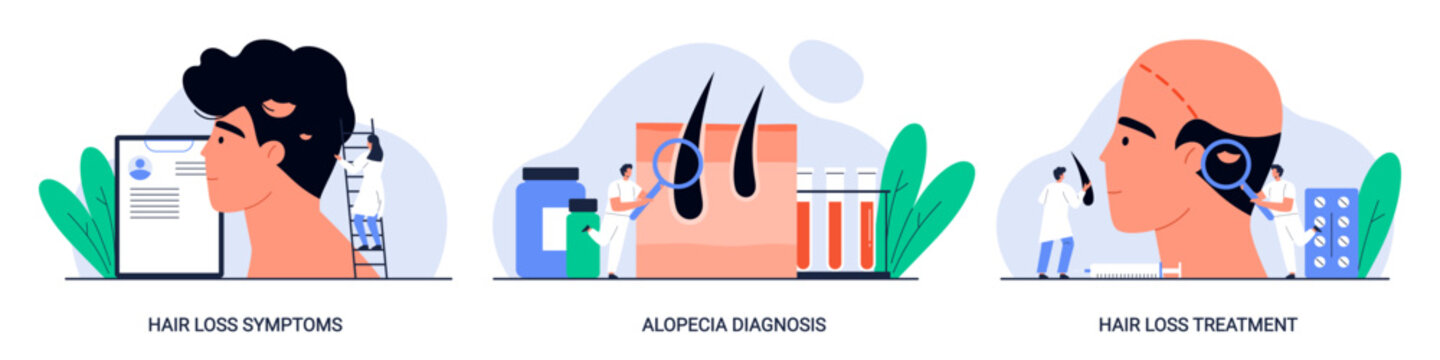 Hair loss symptoms, alopecia diagnosis and treatment. Man scalp with baldness and medical equipment. Dermatology, trichology, hair care concept. Isolated vector illustration in cartoon style
