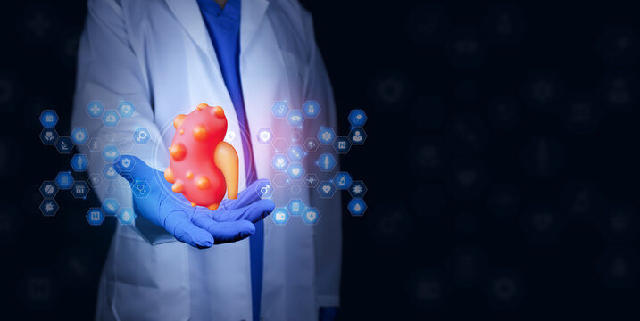 A urologist displays a kidney with cysts and medical icons. Concept of kidney health, modern digital diagnosis of polycystic kidney disease. Isolated doctor