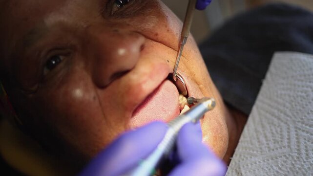 Close-up: Dentist uses dental power instrument in patient's mouth