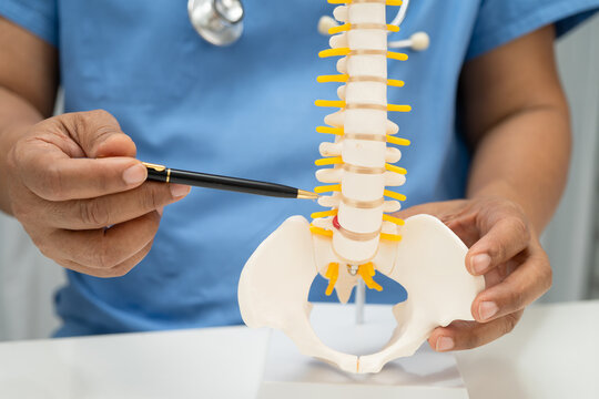 Asian doctor holding spinal nerve and bone model, Lumbar spine displaced herniated disc fragment for treatment medical in the orthopedic department.