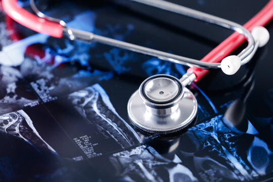 Stethoscope on cervical spine x-ray images reflecting medical diagnostic concept. Mri scan of spinal column showing disc protrusion Top View