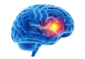 Human brain illustration with pain point isolated on transparent background