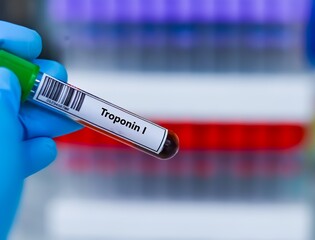 Fototapeta premium Blood sample tube for troponin I test analysis.