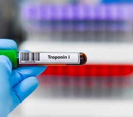 Fototapeta premium Blood sample tube for troponin I test analysis.