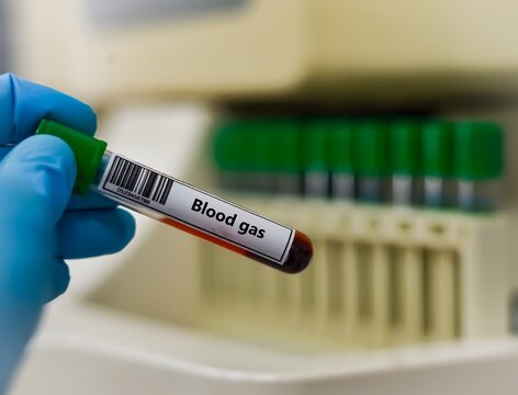 Blood sample tube for blood gas test analysis.