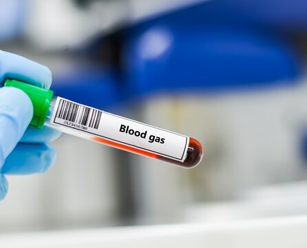 Blood sample tube for blood gas test analysis.