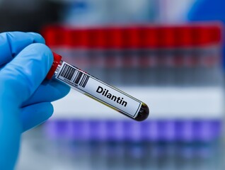 Naklejka premium Blood sample tube for dilantin test analysis.